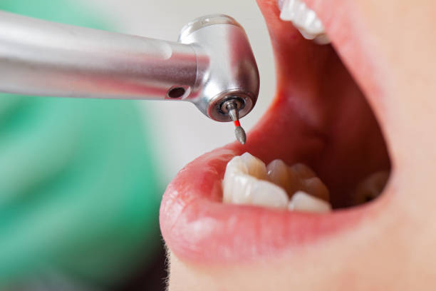 Best Emergency Treatment for Toothache in Coplay, PA